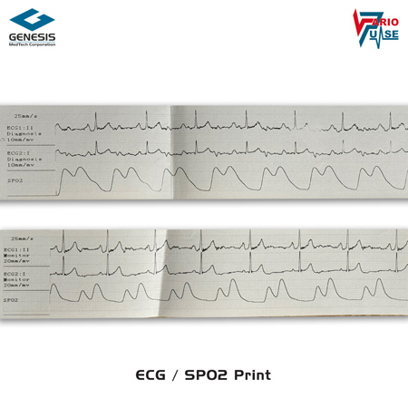 ECG Print