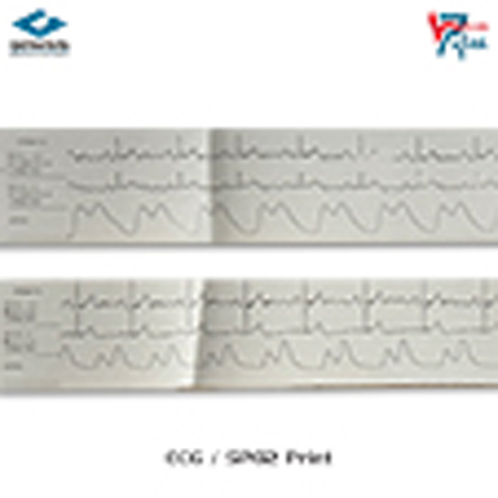 ECG Print